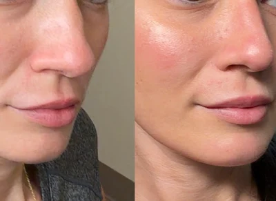 South Florida Center For Cosmetic Surgery