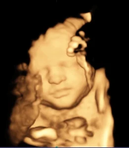 Coastal Baby 3D/4D Ultrasound