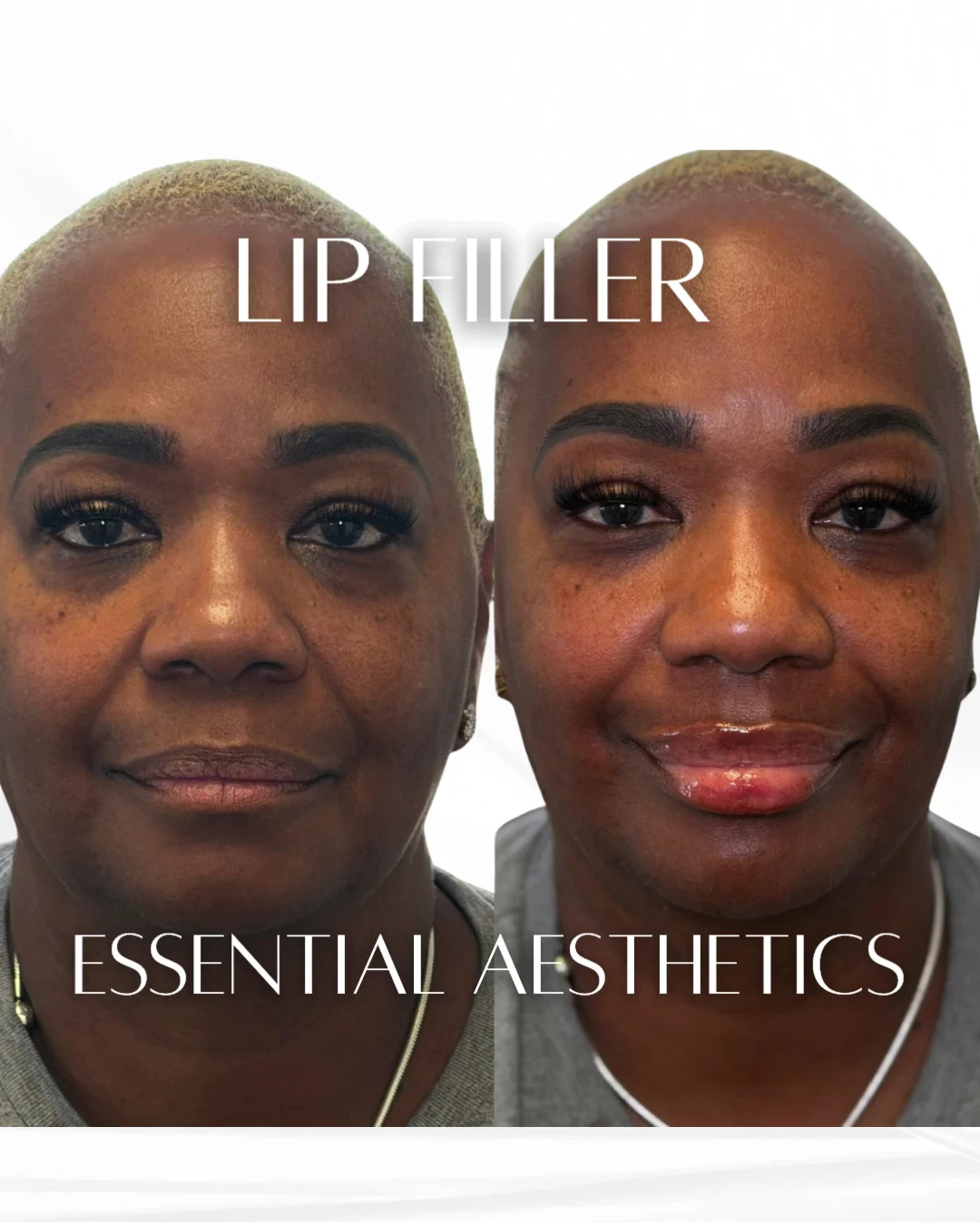 Essential Aesthetics & Health