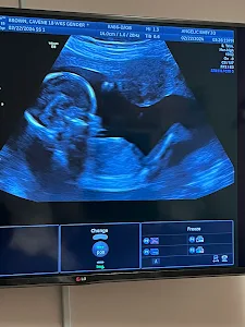 Angelic Baby 3-D Ultrasound
