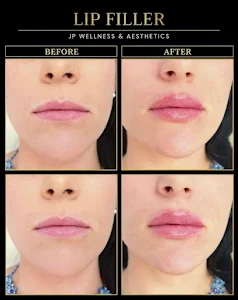 J&P Wellness and aesthetic