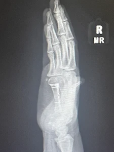 Bahri Orthopedics & Sports Medicine Clinic