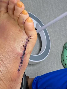 Dr. Ron Adduru: Family Foot and Leg Center - Sarasota