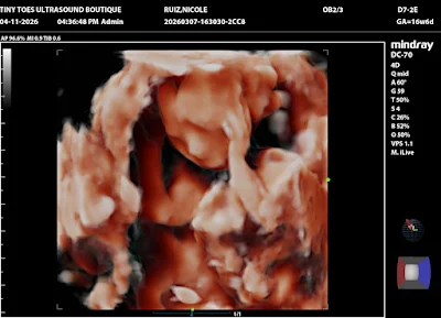 Tiny Toes Ultrasound Boutique 3D/4D & HD