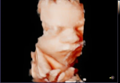 Coastal Baby 3D/4D Ultrasound