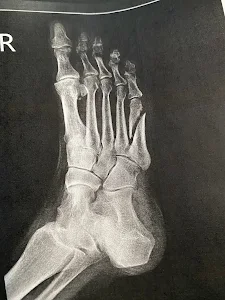 Dr. Ron Adduru: Family Foot and Leg Center - Sarasota