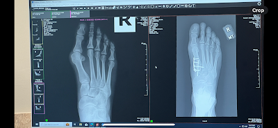 South Florida Orthopaedics & Sports Medicine