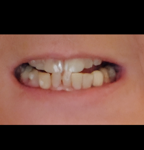 Fine Dentistry of Downtown Orlando