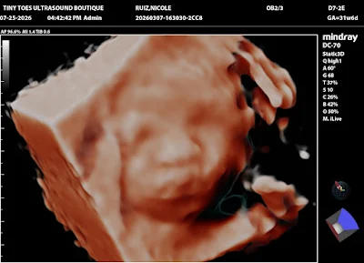 Tiny Toes Ultrasound Boutique 3D/4D & HD