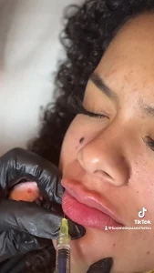 LUXE Med Spa Aesthetics