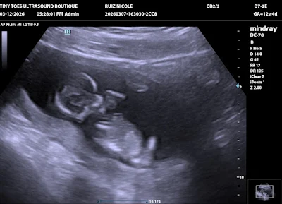Tiny Toes Ultrasound Boutique 3D/4D & HD