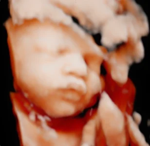 Coastal Baby 3D/4D Ultrasound