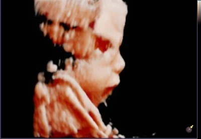 Coastal Baby 3D/4D Ultrasound