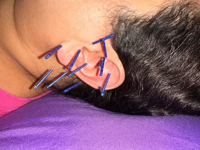 Tree of Life Acupuncture & Asian Medicine