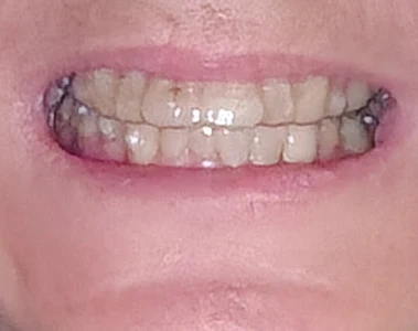 Fine Dentistry of Downtown Orlando