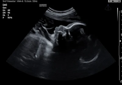 Coastal Baby 3D/4D Ultrasound