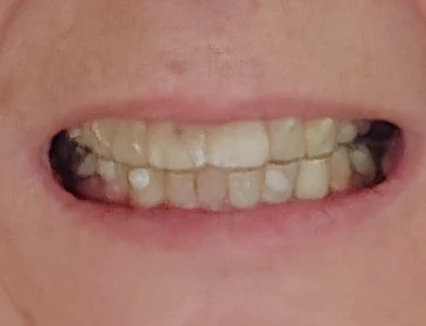 Fine Dentistry of Downtown Orlando