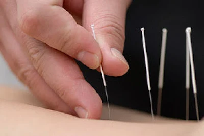 Optimal Light Acupuncture Clinic
