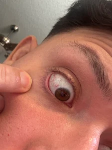 Clay Eye Physicians & Surgeons