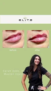 Elite Medical Spa of Sarasota